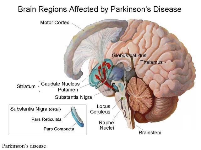 Brain.